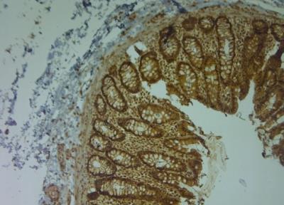 Immunohistochemistry-Paraffin: Aquaporin-9 Antibody [NBP1-30865] - IHC on paraffin sections of human large intestine tissue using Rabbit antibody to AQP9 (240-290): OSA00094W. HIER: 1 mM EDTA, pH 8 for 20 min using Thermo PT Module. Blocking: 0.2% LFDM in TBST filtered thru 0.2 um. Detection was done using HRP polymer  following manufacturer's instructions. Primary antibody: dilution 1: 1000, incubated 30 min at RT (using Autostainer). Sections were counterstained with Harris Hematoxylin.