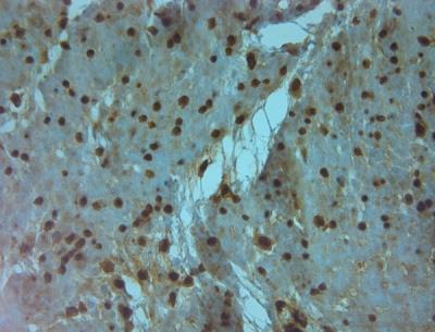 Immunohistochemistry-Paraffin: Aquaporin-9 Antibody [NBP1-30865] - IHC on paraffin sections of human stomach tissue using Rabbit antibody to AQP9 (240-290): OSA00094W.HIER: 1 mM EDTA, pH 8 for 20 min using Thermo PT Module.Blocking: 0.2% LFDM in TBST filtered thru 0.2 um.Detection was done using Novolink HRP polymer following manufacturer's instructions.Primary antibody: dilution 1: 1000, incubated 30 min at RT (using Autostainer).Sections were counterstained with Harris Hematoxylin.