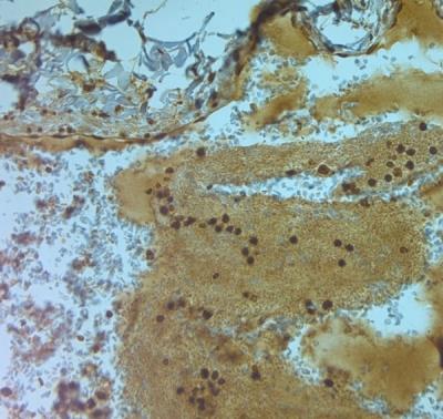 Immunohistochemistry-Paraffin: Aquaporin-9 Antibody [NBP1-30865] - IHC on paraffin sections of human stomach tissue using Rabbit antibody to AQP9 (240-290): OSA00094W. HIER: 1 mM EDTA, pH 8 for 20 min using Thermo PT Module. Blocking: 0.2% LFDM in TBST filtered thru 0.2 um. Detection was done using HRP polymer following manufacturer's instructions. Primary antibody: dilution 1: 1000, incubated 30 min at RT (using Autostainer). Sections were counterstained with Harris Hematoxylin.