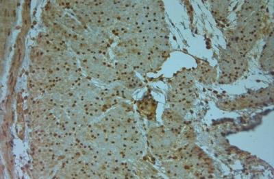 Immunohistochemistry-Paraffin: Aquaporin-9 Antibody [NBP1-30865] - IHC on paraffin sections of human stomach tissue using Rabbit antibody to AQP9 (240-290): OSA00094W. HIER: 1 mM EDTA, pH 8 for 20 min using Thermo PT Module. Blocking: 0.2% LFDM in TBST filtered thru 0.2 um. Detection was done using  HRP polymer  following manufacturer's instructions. Primary antibody: dilution 1: 1000, incubated 30 min at RT (using Autostainer). Sections were counterstained with Harris Hematoxylin.