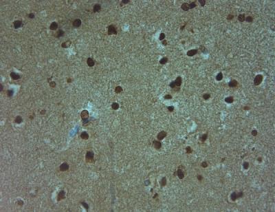 Immunohistochemistry-Paraffin: Aquaporin-9 Antibody [NBP1-30865] - IHC on paraffin sections of human brain tissue using Rabbit antibody to AQP9 (240-290): OSA00094W. HIER: 1 mM EDTA, pH 8 for 20 min using Thermo PT Module. Blocking: 0.2% LFDM in TBST filtered thru 0.2 um. Detection was done using  HRP polymer  following manufacturer's instructions. Primary antibody: dilution 1: 1000, incubated 30 min at RT (using Autostainer). Sections were counterstained with Harris Hematoxylin.