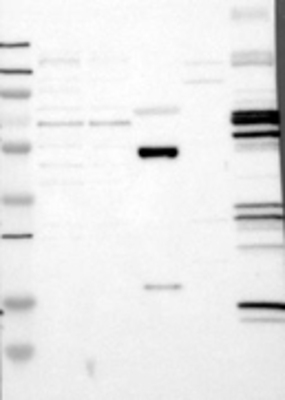 Western Blot: DCLK3 Antibody [21890002] - Samples:  Lane 1, Marker [kDa]: 250, 130, 95, 72, 55, 36, 28, 17, 11  Lane 2, RT-4 Lane 3, U-251MG sp  Lane 4, Human Plasma  Lane 5, Liver  Lane 6, Tonsil, Target weight [kDa]:  74   Validation score:  2   Validation description:  Supportive - Band of predicted size in kDa (+/-20%) with additional bands present.