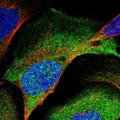 Immunocytochemistry/Immunofluorescence: SUG1 Antibody [NBP1-87372] - Immunofluorescent staining of human cell line U-2 OS shows localization to plasma membrane & cytosol.