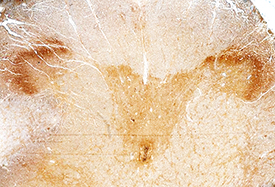 RGM‑A was detected in immersion fixed paraffin-embedded sections of human brain (spinal cord) using Goat Anti-Human RGM‑A Antigen Affinity-purified Polyclonal Antibody (Catalog # AF2459) at 15 µg/mL overnight at 4 °C. Before incubation with the primary antibody, tissue was subjected to heat-induced epitope retrieval using Antigen Retrieval Reagent-Basic (Catalog # CTS013). Tissue was stained using the Anti-Goat HRP-DAB Cell & Tissue Staining Kit (brown; Catalog # CTS008) and counterstained with hematoxylin (blue). Specific staining was localized to the dorsal horn. View our protocol for Chromogenic IHC Staining of Paraffin-embedded Tissue Sections.