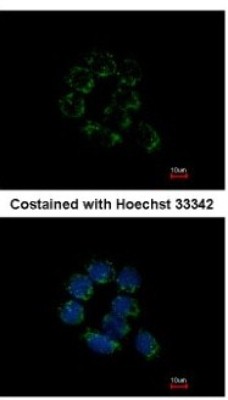 Immunocytochemistry/Immunofluorescence: DBT Antibody [NBP1-31760] - Analysis of methanol-fixed A431, using antibody at 1:200 dilution.