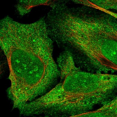 Immunocytochemistry/Immunofluorescence: LRRC35 Antibody [NBP1-89578] - Staining of human cell line U-2 OS shows positivity in nucleus, nucleoli and plasma membrane.