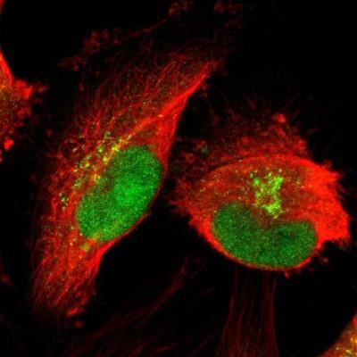 Immunocytochemistry/Immunofluorescence: RIZ1 Antibody [NBP1-89644] - Staining of human cell line U-251MG shows positivity in nucleus and golgi apparatus.