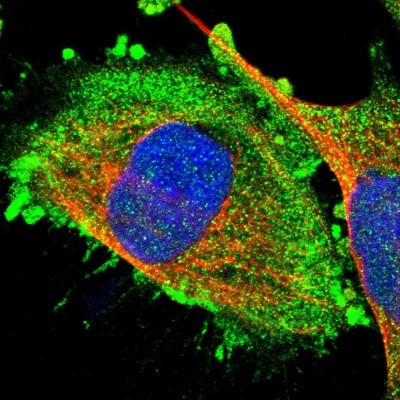Immunocytochemistry/Immunofluorescence: RGP1 Antibody [NBP1-89621] - Immunofluorescent staining of human cell line U-251 MG shows localization to plasma membrane & cytosol.