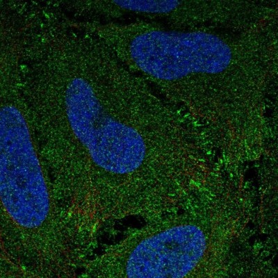 Immunocytochemistry/Immunofluorescence: ZBED3 Antibody [NBP2-33772] - Staining of human cell line HeLa shows localization to plasma membrane.