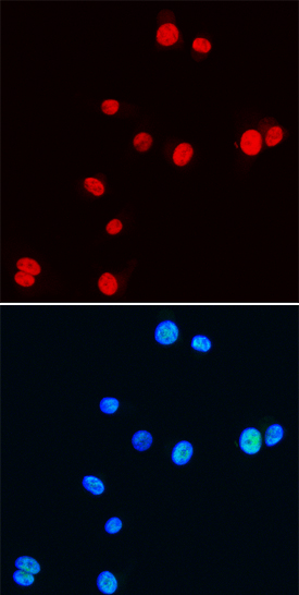 NKX3.1 was detected in immersion fixed NIH‑3T3 mouse embryonic fibroblast cell line using Rat Anti-Mouse NKX3.1 Monoclonal Antibody (Catalog # MAB6475) at 25 µg/mL for 3 hours at room temperature. Cells were stained using the NorthernLights™ 557-conjugated Anti-Rat IgG Secondary Antibody (red, upper panel; Catalog # NL013) and counterstained with DAPI (blue, lower panel). Specific staining was localized to nuclei. View our protocol for Fluorescent ICC Staining of Cells on Coverslips.