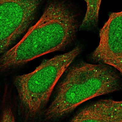 Immunocytochemistry/Immunofluorescence: FBXO46 Antibody [NBP2-31891] - Staining of human cell line U-2 OS shows localization to nucleus, cytosol & vesicles.