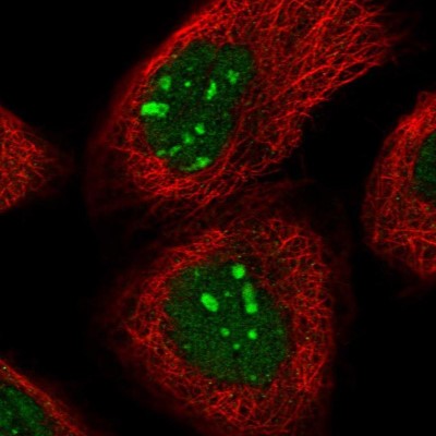 Immunocytochemistry/Immunofluorescence: Homez Antibody [NBP2-32661] - Immunofluorescent staining of human cell line A-431 shows localization to nucleus & nucleoli.