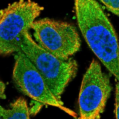 Immunocytochemistry/Immunofluorescence: LSM12 Antibody [NBP2-14205] - Immunofluorescent staining of human cell line PC-3 shows localization to cytosol.