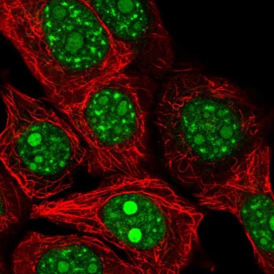 Immunocytochemistry/Immunofluorescence: REXO4 Antibody [NBP2-13221] - Immunofluorescent staining of human cell line MCF7 shows localization to nucleoli & nuclear speckles.