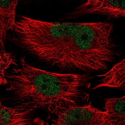 Immunocytochemistry/Immunofluorescence: MEIG1 Antibody [NBP1-94132] - Staining of human cell line U-251 MG shows positivity in nucleus but not nucleoli.