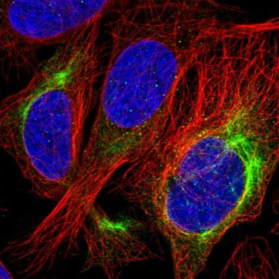Immunocytochemistry/Immunofluorescence: Als2 Antibody [NBP2-14284] - Immunofluorescent staining of human cell line U-2 OS shows localization to intermediate filaments.