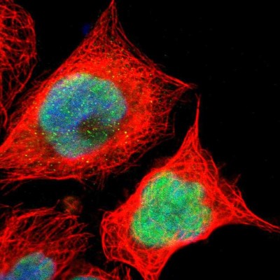 Immunocytochemistry/Immunofluorescence: Josephin1 Antibody [NBP1-87864] - Staining of human cell line A-431 shows positivity in nuclei.
