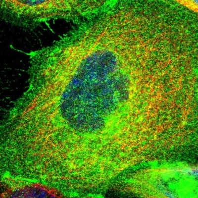 Immunocytochemistry/Immunofluorescence: PGAP3 Antibody [NBP1-86692] - Immunofluorescent staining of human cell line A-431 shows localization to plasma membrane & cytosol.