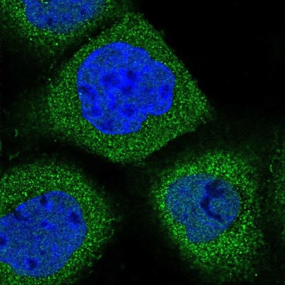 Immunocytochemistry/Immunofluorescence: Synaptogyrin 1 Antibody [NBP1-87532] - Staining of human cell line A-431 shows localization to cytosol.
