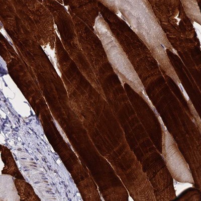 Immunohistochemistry-Paraffin: Troponin T Type 3 (fast skeletal) Antibody [NBP1-92534] - Staining of human skeletal muscle shows strong cytoplasmic positivity in myocytes.