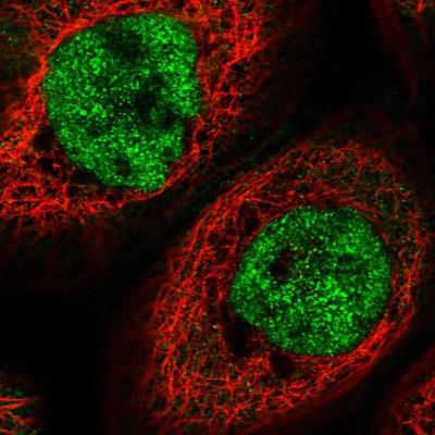 Immunocytochemistry/Immunofluorescence: TPRX1 Antibody [NBP1-92524] - Staining of human cell line A-431 shows positivity in nucleus but not nucleoli.