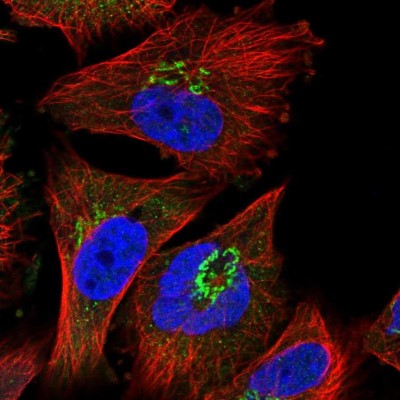 Immunocytochemistry/Immunofluorescence: C17orf74 Antibody [NBP1-91065] - Staining of human cell line U-251MG shows positivity in golgi apparatus.