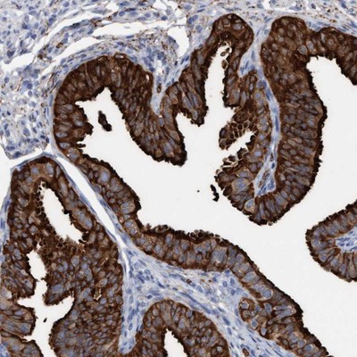 Immunohistochemistry-Paraffin: C17orf74 Antibody [NBP1-91065] - Staining of human fallopian tube shows strong cytoplasmic and membranous positivity in glandular cells.