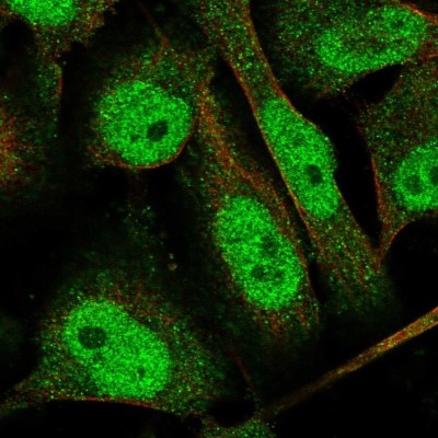 Immunocytochemistry/Immunofluorescence: TTC37 Antibody [NBP1-93640] - Staining of human cell line U-251 MG shows localization to nucleoplasm & cytosol.
