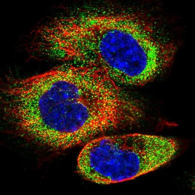 Immunocytochemistry/Immunofluorescence: GJC3 Antibody [NBP1-88040] - Staining of human cell line A-431 shows positivity in cytoplasm.