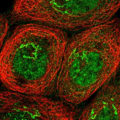 Immunocytochemistry/Immunofluorescence: HKR1 Antibody [NBP1-86826] - Immunofluorescent staining of human cell line A-431 shows localization to nucleoplasm & the Golgi apparatus.