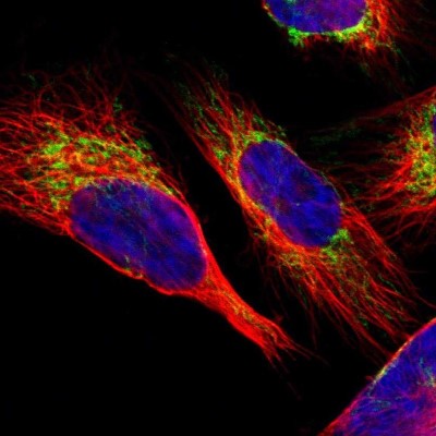 Immunocytochemistry/Immunofluorescence: SLC25A31 Antibody [NBP1-89073] - Immunofluorescent staining of human cell line U-251 MG shows localization to mitochondria.