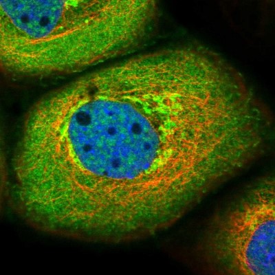 Immunocytochemistry/Immunofluorescence: Roquin Antibody [NBP1-89591] - Immunofluorescent staining of human cell line A-431 shows localization to plasma membrane, cytosol & the Golgi apparatus.