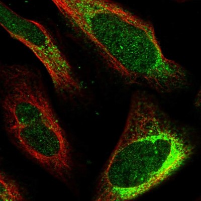 Immunocytochemistry/Immunofluorescence: LINS1 Antibody [NBP1-89584] - Staining of human cell line U-2 OS shows positivity in nucleus but not nucleoli and cytoplasm.