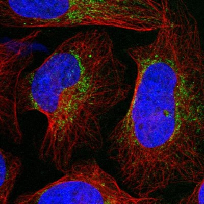 Immunocytochemistry/Immunofluorescence: UST Antibody [NBP1-89383] - Immunofluorescent staining of human cell line U-2 OS shows localization to mitochondria.