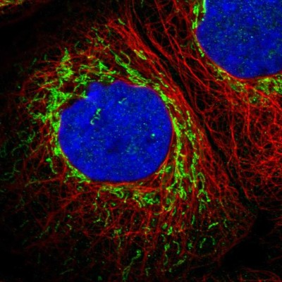 Immunocytochemistry/Immunofluorescence: ETFB Antibody [NBP1-89455] - Immunofluorescent staining of human cell line A-431 shows localization to mitochondria.