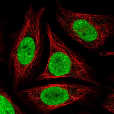 Immunocytochemistry/Immunofluorescence: GLTSCR1 Antibody [NBP2-30603] - Staining of human cell line SiHa shows positivity in nucleus but excluded from the nucleoli.