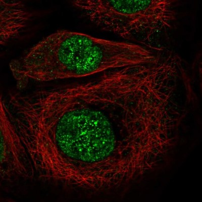Immunocytochemistry/Immunofluorescence: TAF4B Antibody [NBP1-90657] - Immunofluorescent staining of human cell line A-431 shows localization to nucleoplasm.