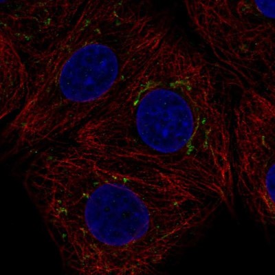 Immunocytochemistry/Immunofluorescence: AIG1 Antibody [NBP2-38897] - Immunofluorescent staining of human cell line MCF7 shows localization to the Golgi apparatus.
