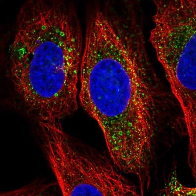 Immunocytochemistry/Immunofluorescence: HBQ1 Antibody [NBP2-38960] - Staining of human cell line U-2 OS shows localization to lipid droplets.