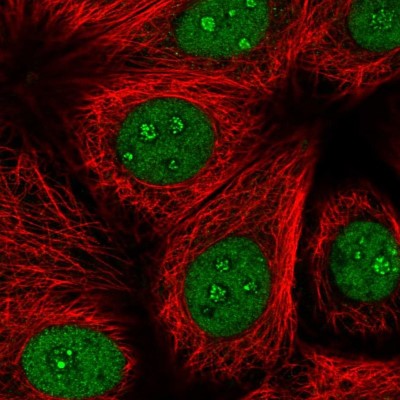Immunocytochemistry/Immunofluorescence: BTBD10 Antibody [NBP2-38558] - Immunofluorescent staining of human cell line MCF7 shows localization to nucleus & nucleoli fibrillar center.