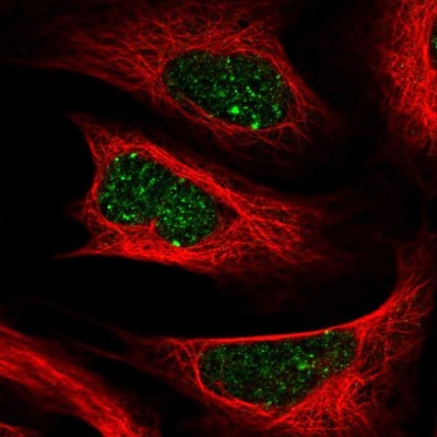 Immunocytochemistry/Immunofluorescence: ALKBH8 Antibody [NBP2-38928] - Staining  of human cell line U-2 OS shows positivity in nucleus.