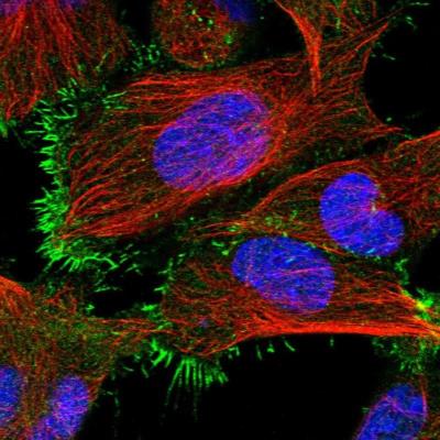 Immunocytochemistry/Immunofluorescence: PPEF1 Antibody [NBP1-87239] - Staining of human cell line U-251MG shows positivity in plasma membrane.