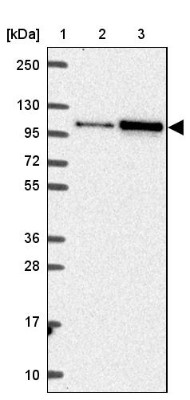 Western Blot: SMARCA6 Antibody [NBP2-38986] - Lane 1: Marker  [kDa] 250, 130, 95, 72, 55, 36, 28, 17, 10.  Lane 2: Human cell line RT-4.  Lane 3: Human cell line U-251MG