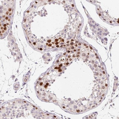Immunohistochemistry: SMARCA6 Antibody [NBP2-38986] - Staining of human testis shows strong nuclear positivity in  cells in seminiferous ducts.
