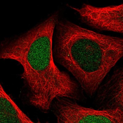 Immunocytochemistry/Immunofluorescence: Uridine Phosphorylase 1/UPP1 Antibody [NBP2-30852] - Immunofluorescent staining of human cell line U-2 OS shows localization to nucleus.