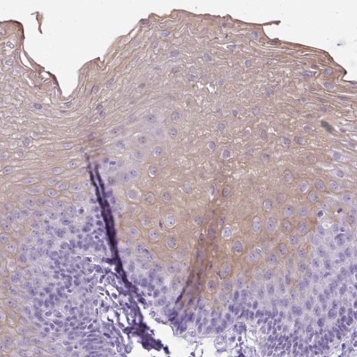 Immunohistochemistry-Paraffin: Uridine Phosphorylase 1/UPP1 Antibody [NBP2-30852] - Staining of human esophagus shows cytoplasmic positivity in squamous epithelial cells.