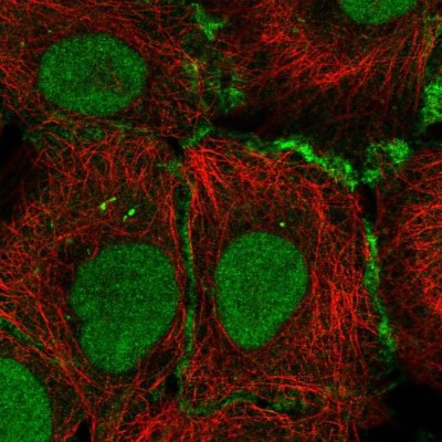 Immunocytochemistry/Immunofluorescence: Connexin 30.3/GJB4 Antibody [NBP2-55398] - Staining of human cell line HaCaT shows localization to nucleus & cell junctions.