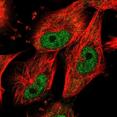 Immunocytochemistry/Immunofluorescence: NUP37 Antibody [NBP2-55454] - Staining of human cell line U-251 MG shows localization to nucleoplasm.