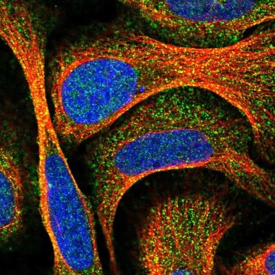 Immunocytochemistry/Immunofluorescence: Ccd1/DIXDC1 Antibody [NBP2-55386] - Staining of human cell line U-2 OS shows localization to cytosol.