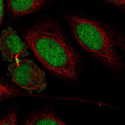 Immunocytochemistry/Immunofluorescence: KIAA1143 Antibody [NBP2-57324] - Staining of human cell line SiHa shows localization to nucleus & cytokinetic bridge.